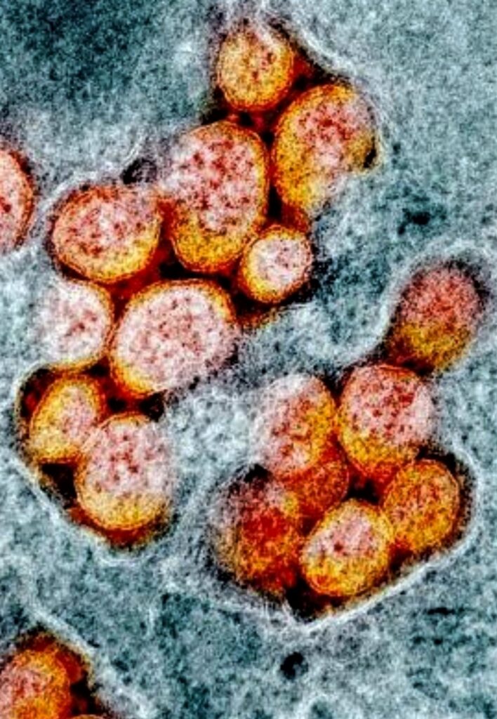 photo of actual COVCID viruses